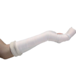 Ruixin Plastic Splint - 图片 3